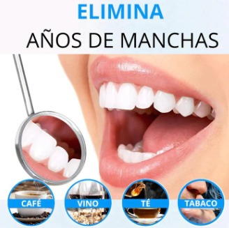 Snapon Smile/Carillas para Dientes