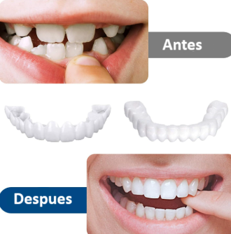 Snapon Smile/Carillas para Dientes