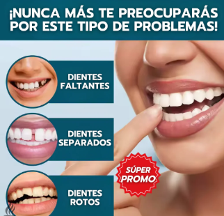 Snapon Smile/Carillas para Dientes